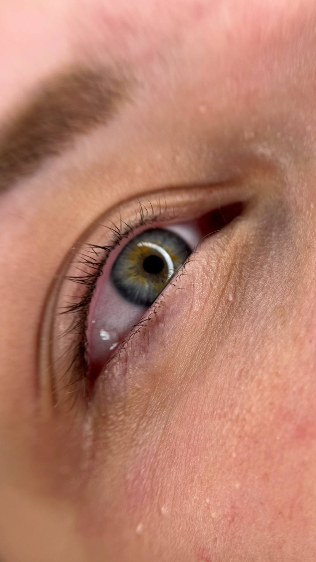 Депиляция шугаринг подмышек